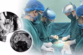 Xử trí kịp thời ca rau bong non, cứu sống sản phụ và thai nhi 36 tuần