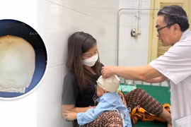 Trẻ hơn 3 tuổi chấn thương sọ não nặng do tai nạn 