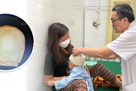 Trẻ hơn 3 tuổi chấn thương sọ não nặng do tai nạn 