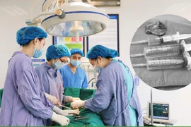 Đau bụng dưới do u buồng trứng tái phát phức tạp