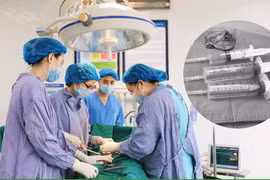 Đau bụng dưới do u buồng trứng tái phát phức tạp