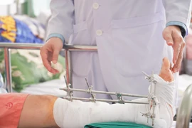 Cách sơ cứu, xử lý chi đứt lìa do máy cắt cỏ 