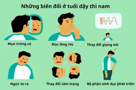 Nam giới chậm dậy thì ảnh hưởng nghiêm trọng đến sinh sản, sức khỏe toàn thân