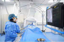 Can thiệp đặt stent thành công cho người bệnh nhồi máu cơ tim đã đặt 2 stent