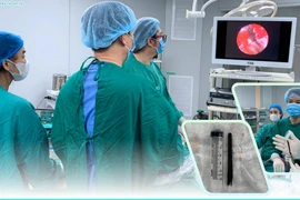 Dị vật đâm xuyên mắt vào nền sọ, cảnh báo tai nạn cực kỳ nguy hiểm