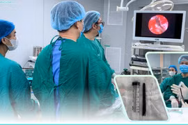 Dị vật đâm xuyên mắt vào nền sọ, cảnh báo tai nạn cực kỳ nguy hiểm