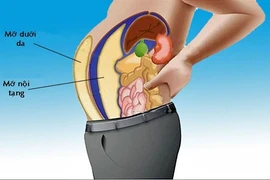 Tích mỡ bụng, mỡ nội tạng gây tim mạch, ung thư