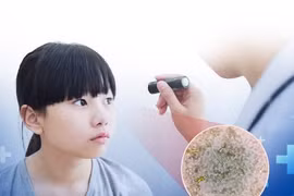 Giun đũa chó mèo ký sinh khắp nơi trong cơ thể