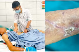 Ngã đập tay vào miếng gỗ, bệnh nhân cứng hàm, khó nói