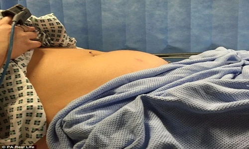 Nhiễm độc băng vệ sinh người mất trí nhớ, kẻ bị thần chết sờ gáy