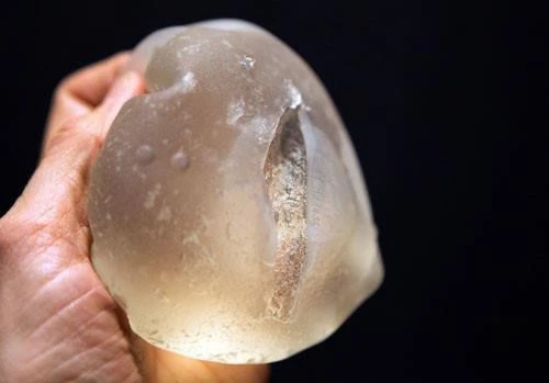 Nổ túi ngực khi đi máy bay, bác sĩ nói có nổ vỡ được không, sự thực bất ngờ