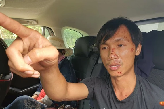 Xe 16 chỗ đâm xe tải, 8 người chết: Tài xế kể phút “đấu đầu” kinh hoàng