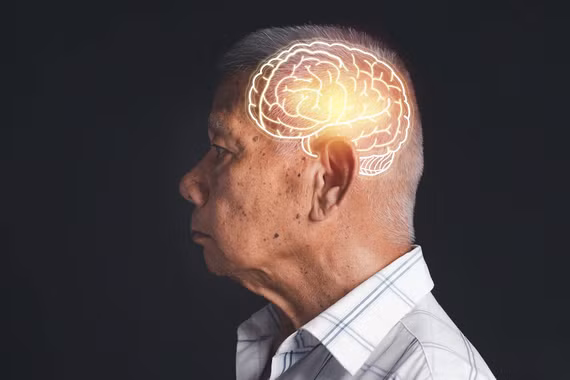 Chỉ cần 3.000 bước mỗi ngày có thể giúp bảo vệ não khỏi bệnh Alzheimer