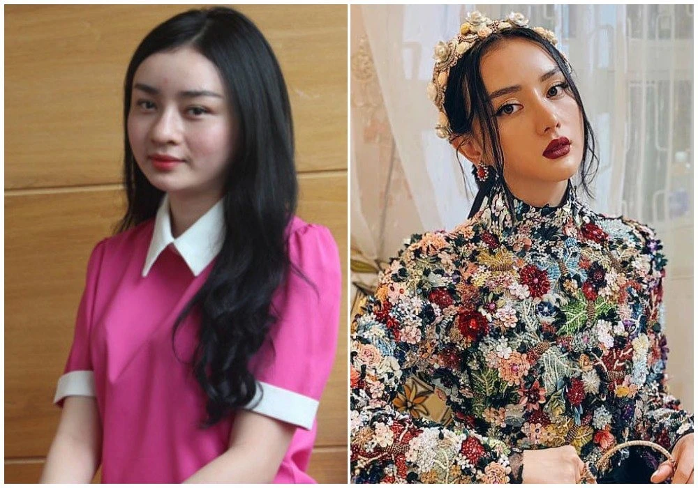 Cô gái miền Tây 'vịt hóa thiên nga' nhờ thẩm mỹ giờ ra sao?