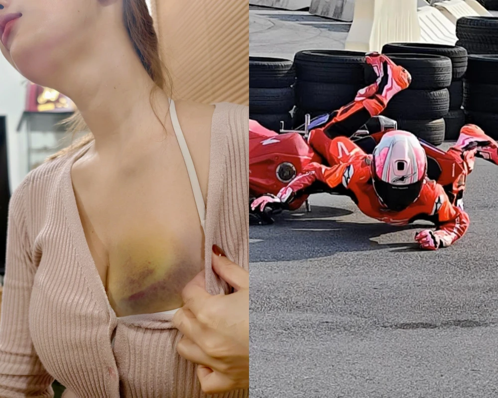 Gặp tai nạn khi lái mô-tô, gái xinh khiến fan xót xa