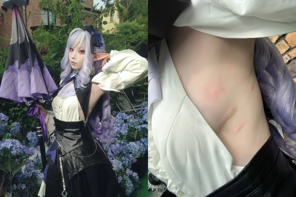 Hết mình vì đam mê, nữ coser lộ ảnh "làm mồi" cho muỗi