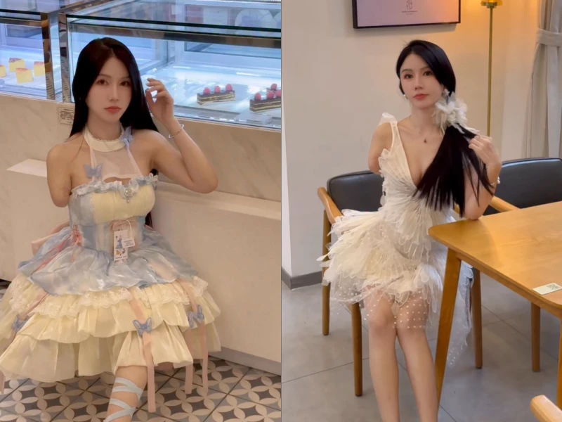 Gặp tai nạn mất một cánh tay, cô gái vẫn nổi tiếng nhờ nhan sắc khó cưỡng