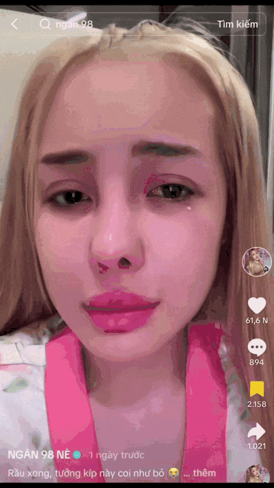 Trước khi "dao kéo", Ngân 98 có đường nét hài hòa, đôi mắt to tròn và nụ cười rạng rỡ. So với thời điểm hiện tại, nhan sắc của cô đã thay đổi đáng kể.