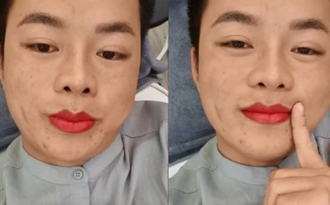 Diện mạo khác lạ của chú rể Hoa Cương sau lần được vợ đưa đi thẩm mỹ