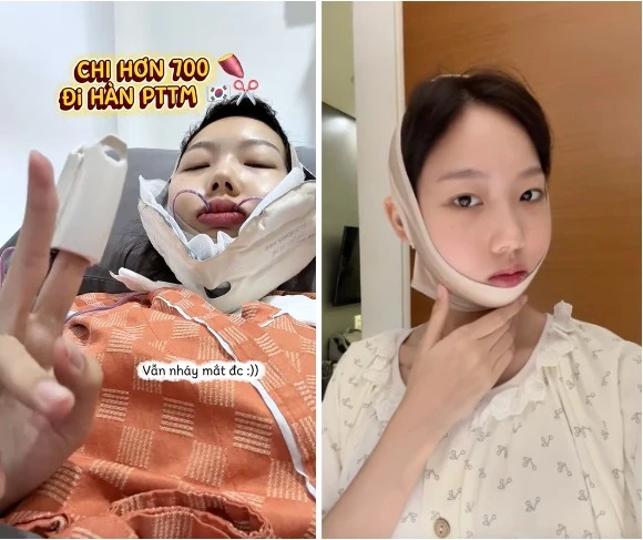 Nữ phản diện của Đảo Thiên Đường chi 700 triệu để hết 'mặt ác'