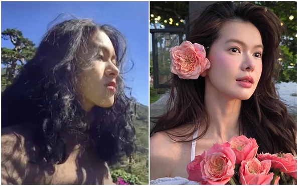 Cô gái Việt là 'nhân chứng' cho sự thay đổi cuộc sống nhờ 'dao kéo'