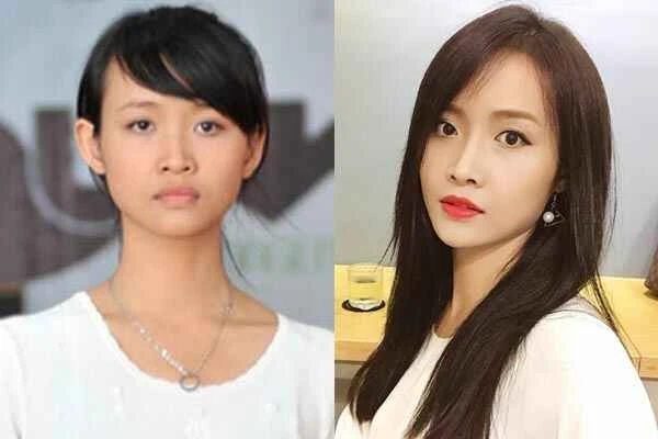 Trương Mỹ Nhân gái xinh thay đổi cuộc sống nhờ 'dao kéo'