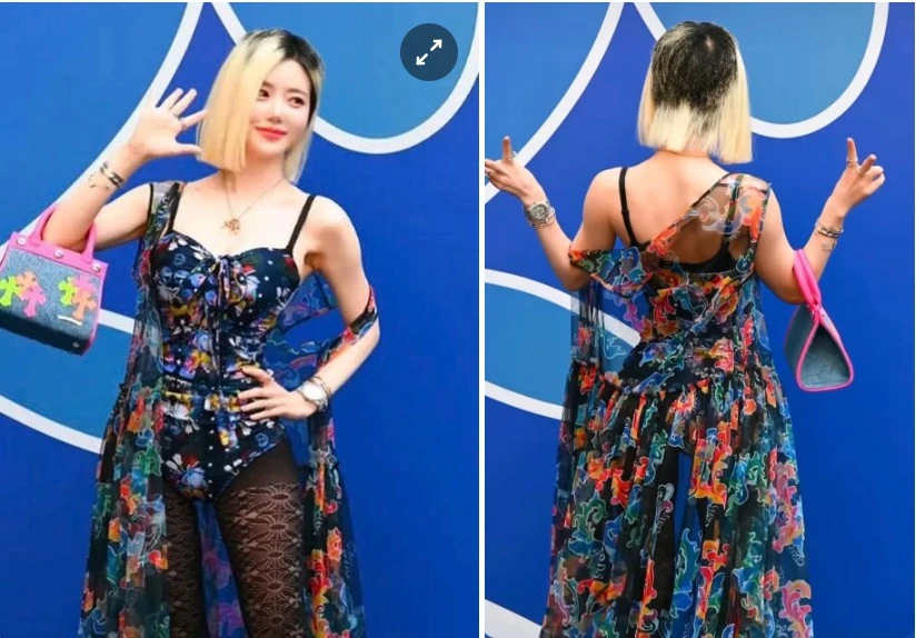 'DJ gợi cảm nhất Hàn Quốc' không còn che giấu mái tóc bị rụng cả mảng