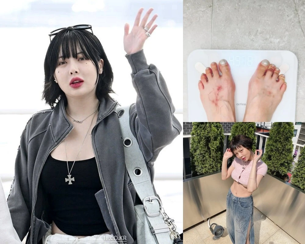 'Mỹ nhân gợi cảm nhất showbiz' HyunA để lộ dấu hiệu đáng lo