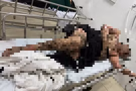 Người đàn ông bị bỏng nặng khi câu cá vướng dây điện