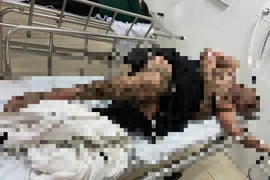 Người đàn ông bị bỏng nặng khi câu cá vướng dây điện