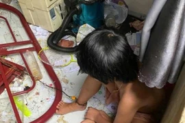 Đắk Lắk: Giám định thương tật hai bé gái bị cha ruột nhốt, xích chân