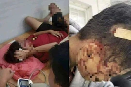 An Giang: Nhóm học sinh xô xát, một nam sinh bị thương