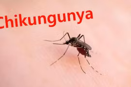 TP HCM: Cảnh báo nguy cơ tái xuất hiện bệnh Chikungunya