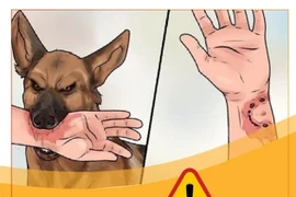 Thêm một trường hợp tử vong do bệnh dại tại Đồng Nai