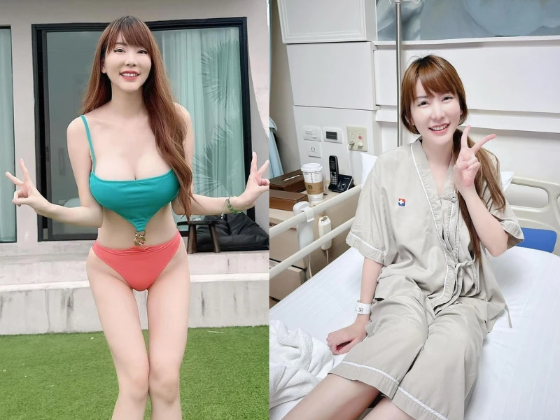 Sở hữu bộ ngực khủng, hot girl người Thái phải phẫu thuật 