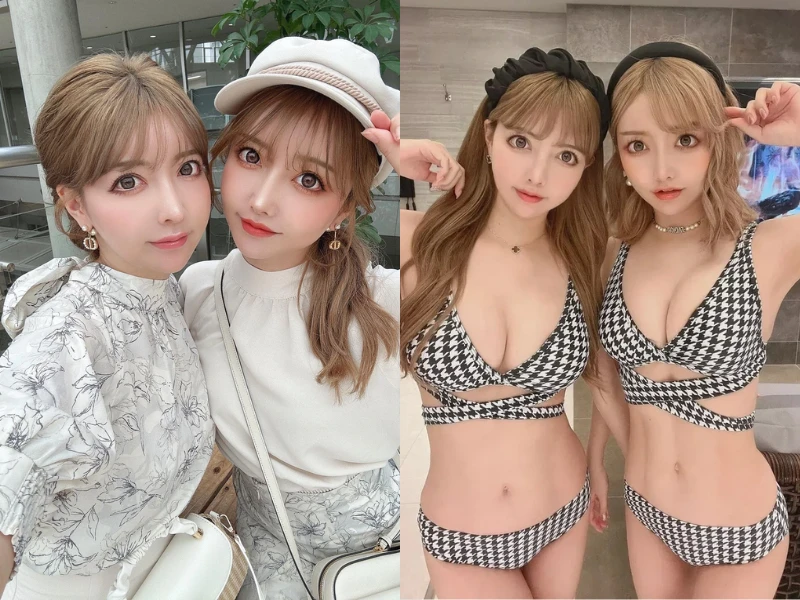 Cặp sinh đôi “dao kéo” cả gương mặt để giống nhau giờ ra sao