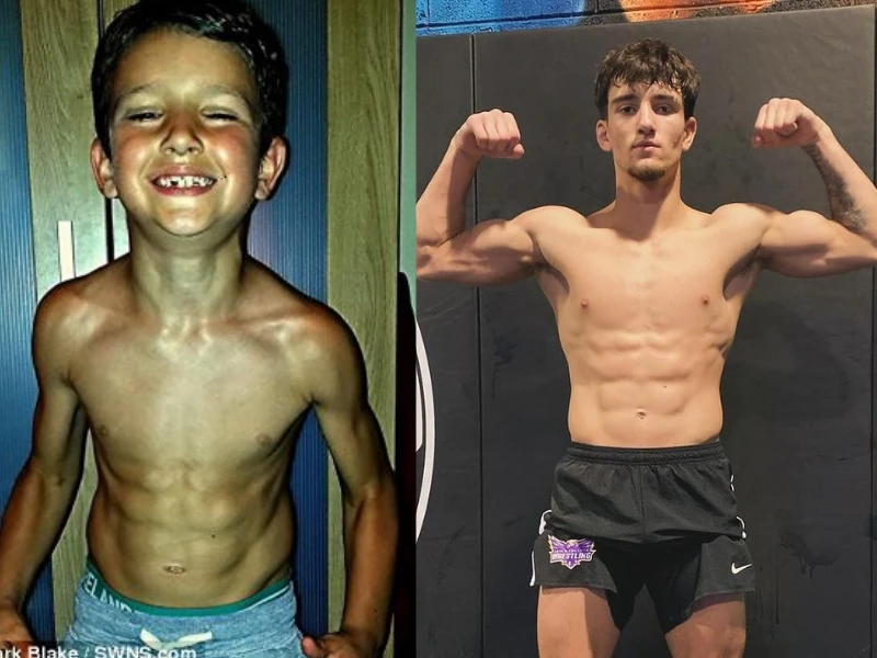 So kè ngoại hình khi trưởng thành của “cậu bé khỏe nhất thế giới“