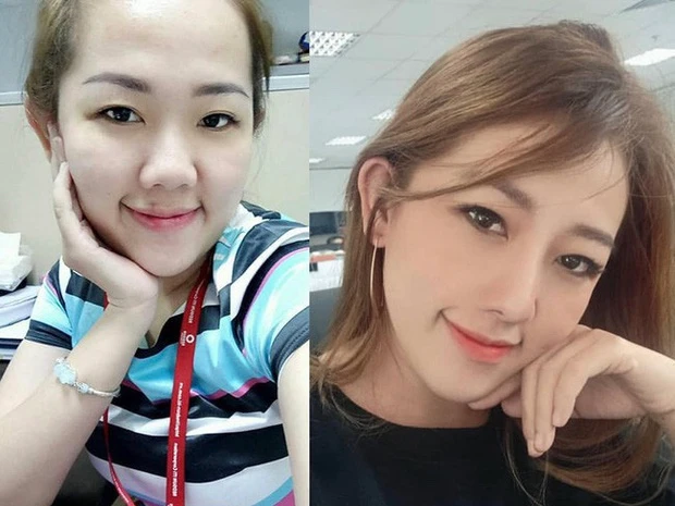 Chỉ sửa một điểm trên mặt, gái xinh thay đổi cuộc sống chóng mặt