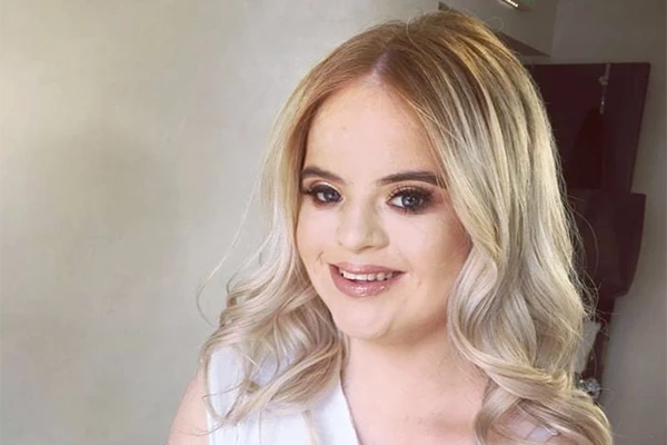 Hot girl mắc bệnh Down và mơ ước thành người mẫu quốc tế