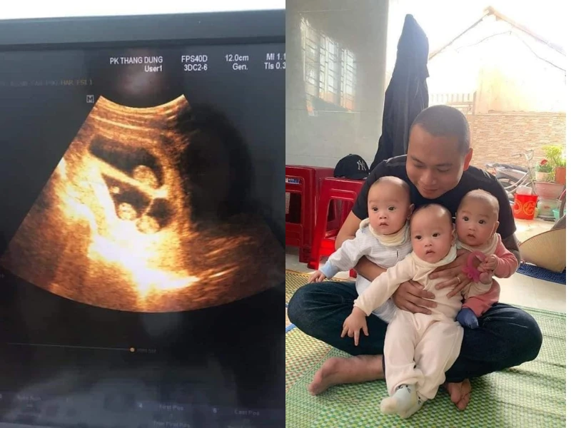 Vợ sinh 3 tự nhiên, anh chồng khoe lên mạng “sướng rơn người” 