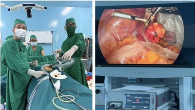 TP HCM: Ca phẫu thuật sản phụ khoa đầu tiên bằng nội soi thành công ở Côn Đảo