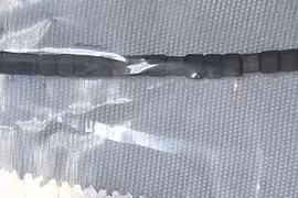 các bác sĩ phát hiện bé đã nuốt tổng cộng 24 viên nam châm dính liền với nhau, dài khoảng 5cm.