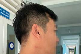 Thầy giáo bóp cổ đồng nghiệp ở Đắk Lắk đối diện hình thức kỷ luật nào? 