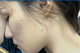 Danh tính cô gái MMA "hạ gục" thanh niên xăm trổ ở hầm giữ xe