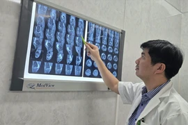 Người phụ nữ đổ gục sau 3 cú đánh pickleball