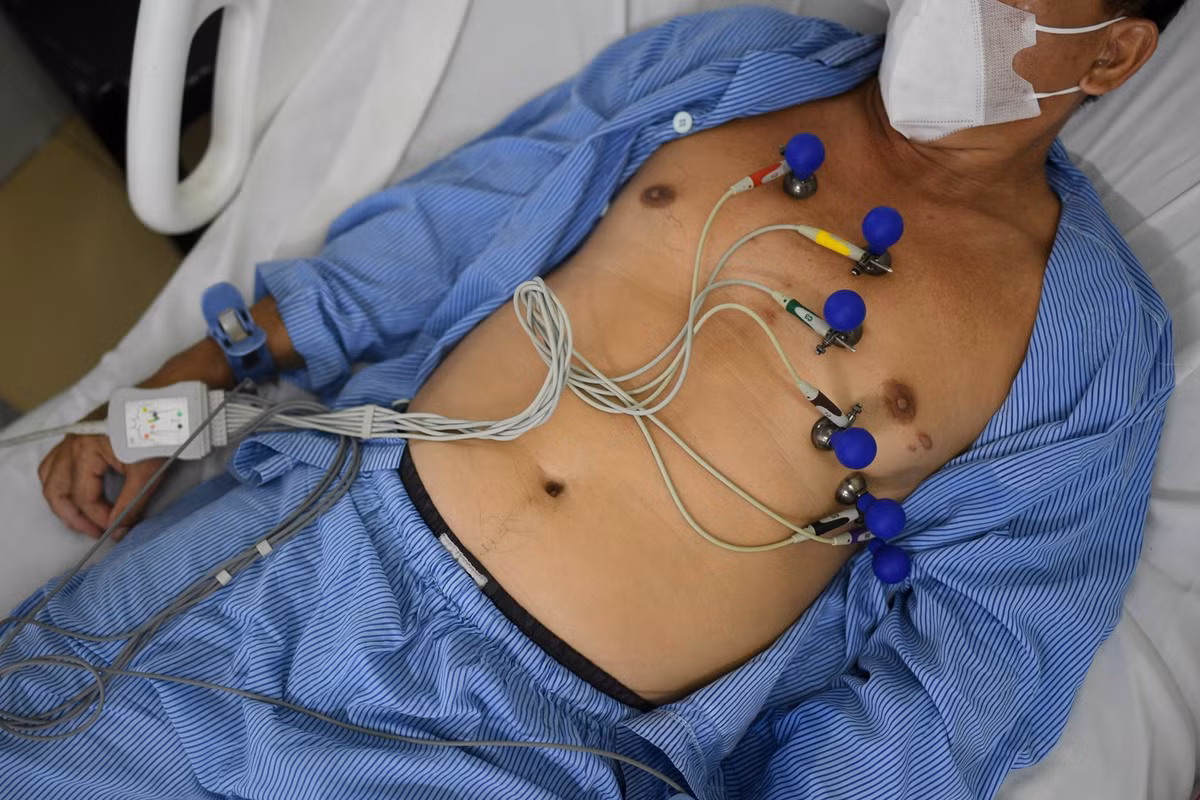 Bệnh nhân nam được gắn các điện cực đo điện tim trong quá trình theo dõi tại Bệnh viện Quân y 175. Những thiết bị này giúp ghi nhận liên tục các chỉ số sinh tồn, hỗ trợ bác sĩ phát hiện sớm rối loạn nhịp hoặc thiếu máu cơ tim để kịp thời điều chỉnh phác đồ điều trị.