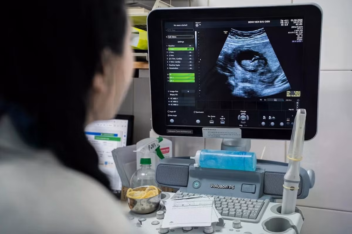 Đây là lần thứ hai chị thực hiện hành trình IVF tại Bệnh viện Bưu Điện. Bốn năm trước, sau nhiều năm mong con, hai vợ chồng đến khám và được xác định nguyên nhân vô sinh từ người chồng không có tinh trùng. Dù đã trải qua phẫu thuật tìm tinh trùng nhưng không đạt kết quả như mong muốn, gia đình quyết định xin tinh trùng từ ngân hàng tinh trùng để thực hiện IVF và may mắn đón con đầu lòng.
