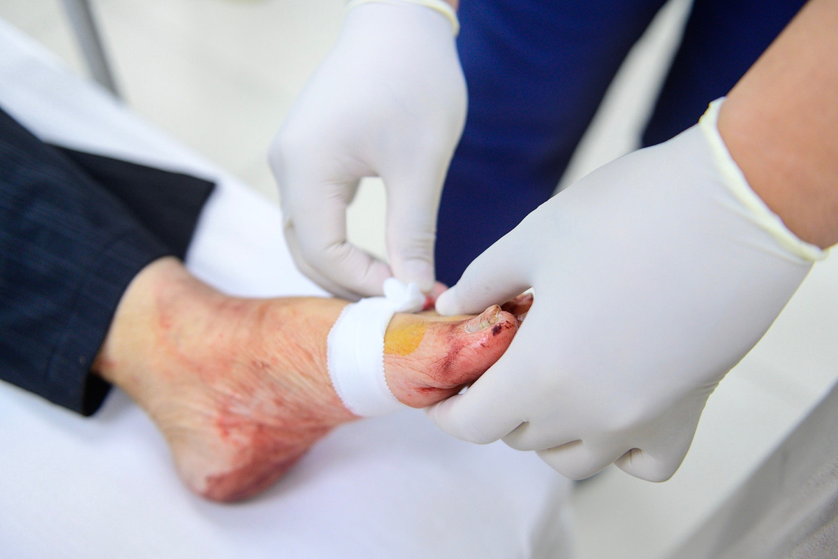 Ở một góc khác của khoa, một phụ nữ 61 tuổi nằm trên băng ca với bàn chân quấn chặt băng ép. Tai nạn xảy ra khi bà đi ăn sáng, bị một vật nhọn xuyên qua dép tổ ong, trúng mạch máu khiến máu chảy nhiều. Bà được chuyển đến sau khi sơ cứu tại trạm y tế phường. Các nhân viên y tế nhanh chóng may vết thương cầm máu và bác sĩ chỉ định đi chụp X-quang kiểm tra vết thương.