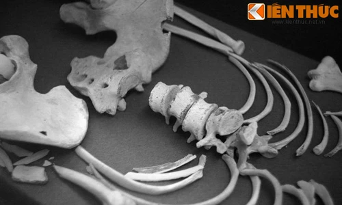 Chuyện ám ảnh về bộ xương người trong Bảo tàng Cần Thơ