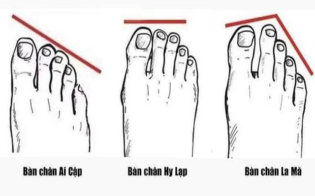 Nhìn độ dài ngón chân cái 3 giây biết ngay tương lai giàu nghèo
